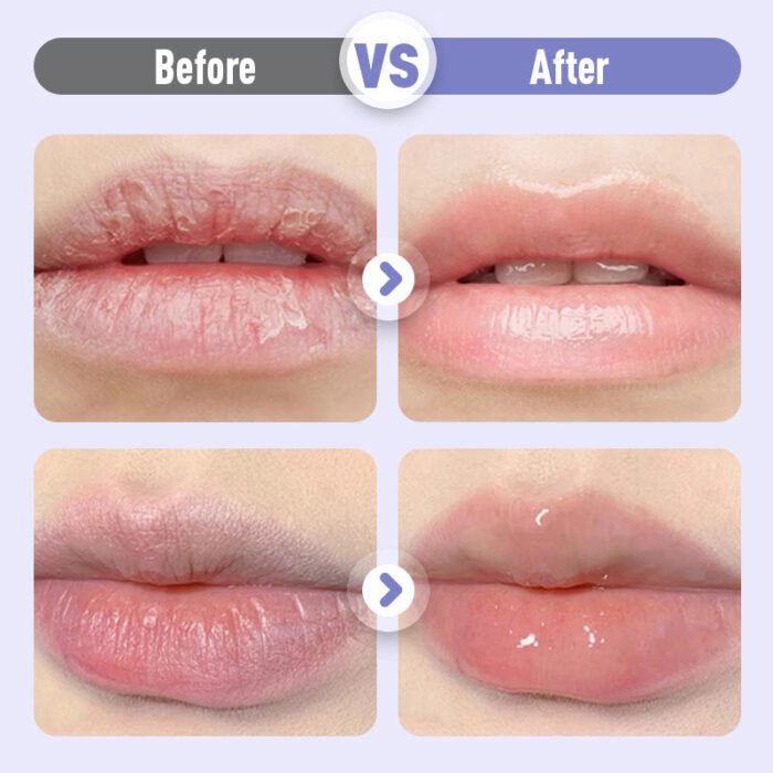 👑Sérum Hydratant Repulpant et Anti-Rides pour les Lèvres💋✨ – Image 6